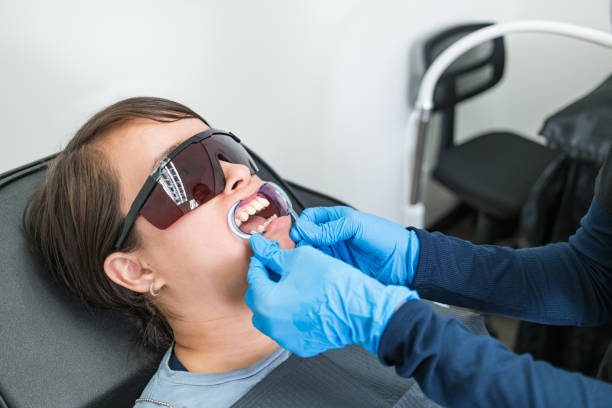 Best Emergency Wisdom Tooth Extraction in Vinton, LA